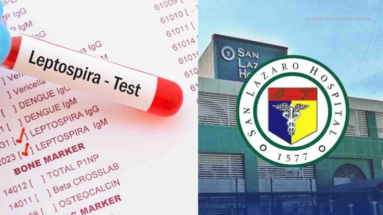 San Lazaro Hospital, bumaba ang leptospirosis admissions